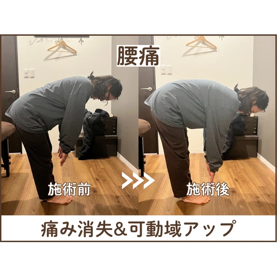 肩こり 腰痛 鍼灸 整体