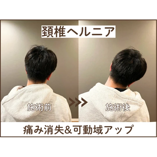 睡眠 自律神経 調整 鍼灸