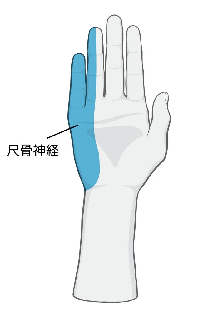 画像2113