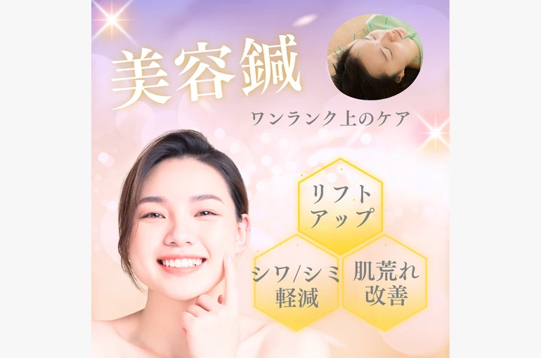 New_美容鍼 (1)