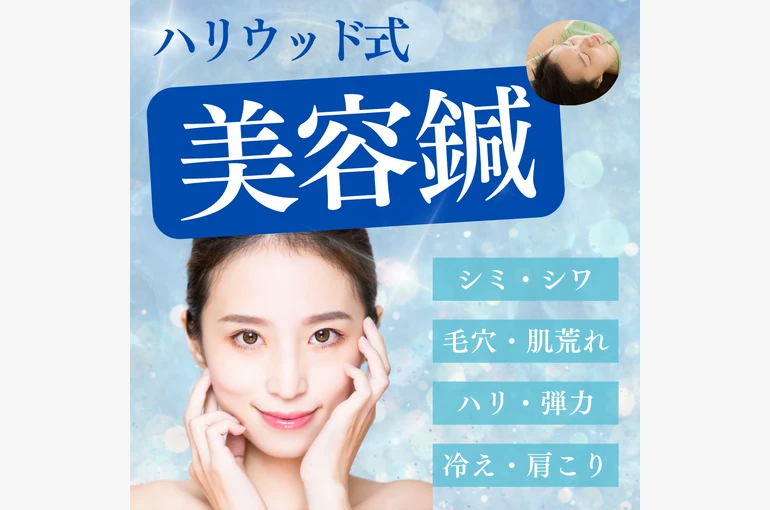 New_美容鍼 (1)